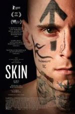 Watch Skin 123movies