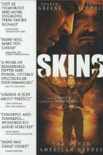 Watch Skins 123movies
