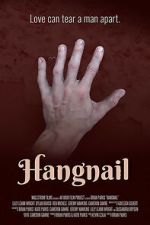 Hangnail